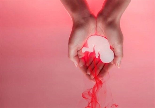 نگاهی بر تاثیر آلودگی هوا برسقط جنین | نفس‌هایی که در نطفه خفه می‌شوند