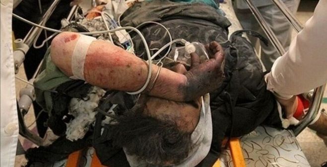 آمار مصدومان چهارشنبه سوری به ۹۲۴ نفر رسید؛ ۱۷ جان‌ باخته و ۹۱ مورد قطع عضو