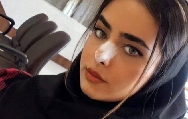 الگوی ناکارآمد روایت‌های علل مرگ روزهای اخیر؛ «آیلار» مست بود؟