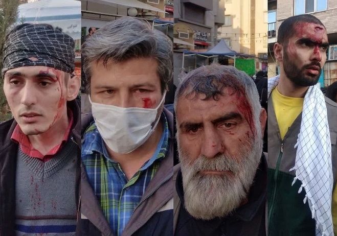 فیلم کامل‌تر از لحظه آغاز بزن بزن هواداران حجاب با یگان ویژه تهـران