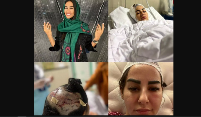 حمله سگ گرانقیمت به رهگذر کوچه؛ فیلم به زمین کوبیدن زن ایرانی توسط پیت‌بول را ببینید! +تصویر