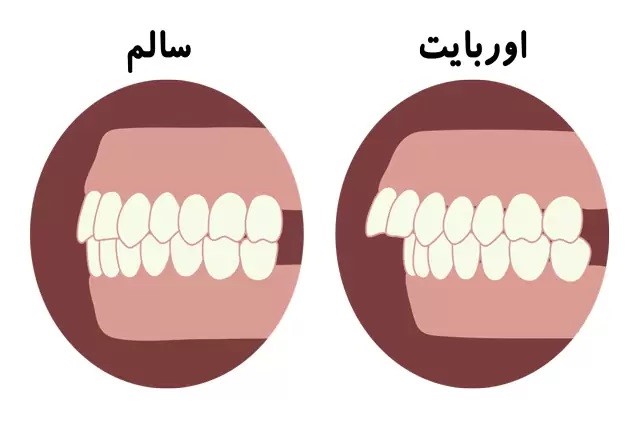 فک سالم و طبیعی