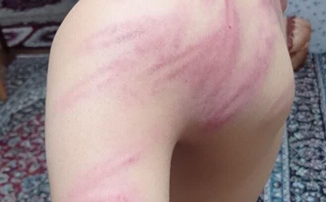 تصاویر ضرب‌وشتم وحشتناک دانش‌آموزان توسط معلم با مشکلات روانی | چطور به او شغل معلمی داده‌اید؟