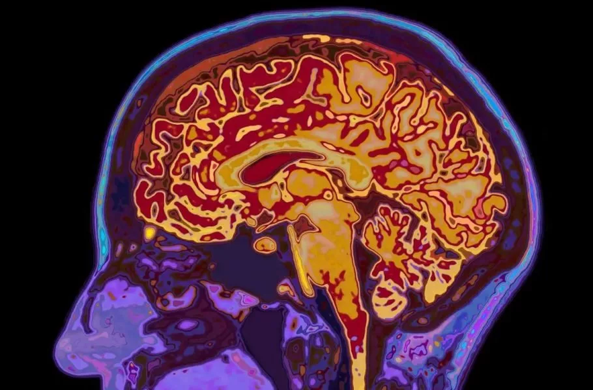 شوک علمی درباره مغز انسان؛ تا ۳۲ سالگی کامل نیستیم   پنج دوران اصلی رشد مغز انسان کدامند؟